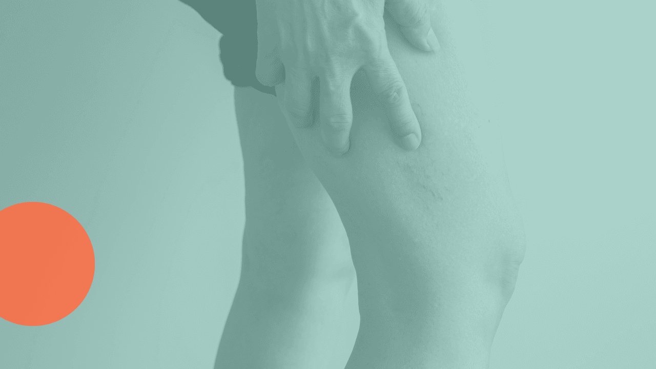 Menopausia, piernas cansadas y varices